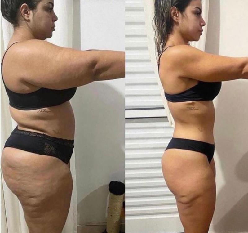 Transformação de Ana Maria